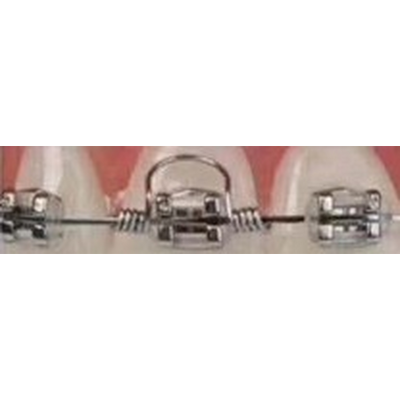 Tooth Torque Spring 2G