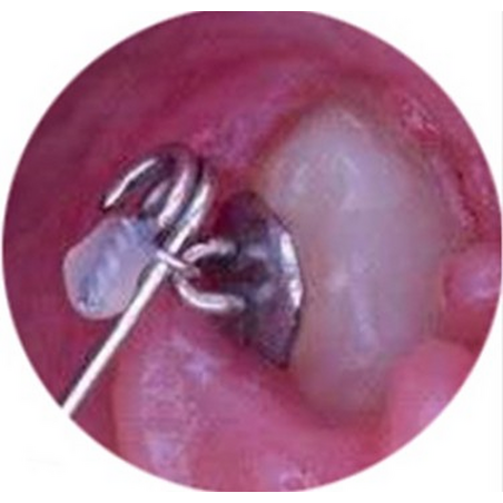 Traction Hook