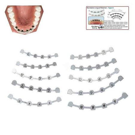 Universal Lingual Retainer